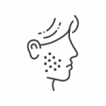 פיגמנטציה של העור